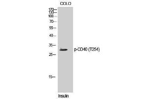 Western Blotting (WB) image for anti-CD40 (CD40) (pThr254) antibody (ABIN3179550) (CD40 antibody  (pThr254))