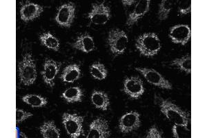 Immunofluorescent staining of A549 (ATCC CCL-185) cells. (HSPD1 antibody)