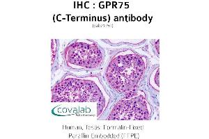 Image no. 2 for anti-G Protein-Coupled Receptor 75 (GPR75) (C-Term) antibody (ABIN1735162) (GPR75 antibody  (C-Term))