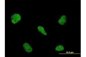 Immunofluorescence (IF) image for anti-RNA Binding Motif Protein 5 (RBM5) (AA 75-184) antibody (ABIN564403)