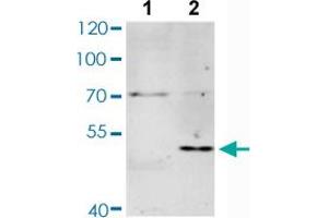 Western blot analysis of Lane 1: Untreated Jurkat cells, Lane 2: Starvation treated Jurkat cells with MAX (phospho S11) polyclonal antibody  at 1:500-1:2000 dilution.