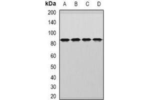 Western blot analysis of DDX1 expression in MCF7 (A), HepG2 (B), mouse brain (C), rat brain (D) whole cell lysates. (DDX1 antibody)
