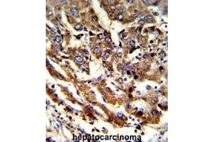 Immunohistochemistry (IHC) image for anti-Endoplasmic Reticulum Protein 29 (ERP29) antibody (ABIN3001703)