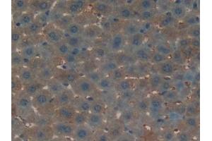 Detection of OC in Mouse Liver Tissue using Polyclonal Antibody to Osteocalcin (OC) (Osteocalcin antibody  (AA 14-95))