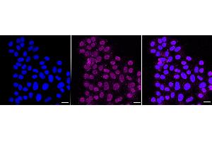 Immunocytochemical staining of HepG2 cells with Erb-b2 receptor tyrosine kinase 2 antibody (ABIN7800156), 1:1,000). (Recombinant ErbB2/Her2 antibody)