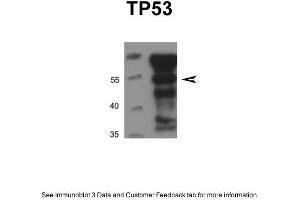 DU145 cells were lysed in IP lysis buffer (20mM HEPES, 1% Triton X-100, 150mM NaCl, 1mMEDTA, 1mM EGTA, 100mM NaF, 10mM Na4P2O7, 1mM Na3VO4, 0. (p53 antibody  (N-Term))