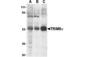 Western blot analysis of TRIM5 alpha expression in human stomach (A), thymus (B), and uterus (C) cell lysate with this product at 2 μg /ml. (TRIM5 antibody  (Isoform alpha, Middle Region))