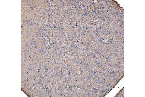 IHC analysis of IRBIT/AHCYL1 using anti-IRBIT/AHCYL1 antibody (ABIN7600030).