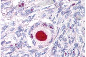 Anti-NR5A1 antibody  ABIN1049145 IHC staining of human ovary. (NR5A1 antibody  (Internal Region))
