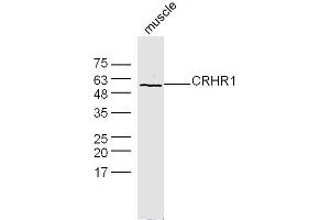 Mouse muscle lysates probed with CRHR1 Polyclonal Antibody, Unconjugated  at 1:300 dilution and 4˚C overnight incubation.