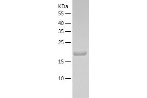 RS1 Protein (AA 24-224) (His tag)