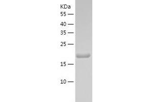 Western Blotting (WB) image for Retinoschisin 1 (RS1) (AA 24-224) protein (His tag) (ABIN7284397) (RS1 Protein (AA 24-224) (His tag))
