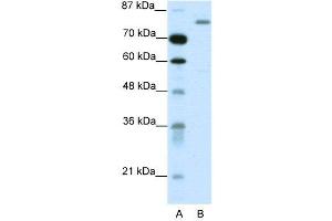 WB Suggested Anti-TRIM28  Antibody Titration: 1. (KAP1 antibody  (C-Term))