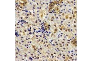 Immunohistochemical analysis of Deltex-2 staining in human kidney formalin fixed paraffin embedded tissue section.