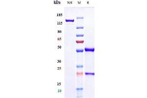 Anti-IL-12b Reference Antibody (ebdarokimab) on SDS-PAGE under reducing (R) condition. (Recombinant IL12B (Ebdarokimab Biosimilar) antibody)