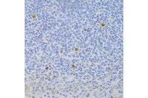 Immunohistochemistry of paraffin-embedded human tonsil using FCN1 Antibody (ABIN2562567) at dilution of 1:100 (40x lens). (FCN1 antibody)