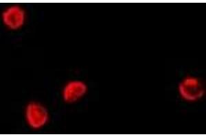 Immunofluorescent analysis of TCF4 staining in Hela cells. (TCF4 antibody)