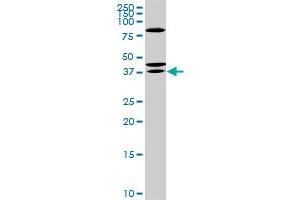 SDR16C5 antibody  (AA 26-309)