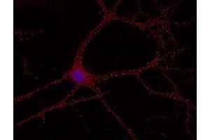 Indirect immunostaining of methanol fixed hippocampus neurons (dilution 1 : 500; red). (RAB5 antibody  (AA 1-215))