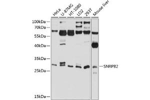Western blot analysis of extracts of various cell lines, using SNRPB2 antibody (ABIN6132758, ABIN6148216, ABIN6148217 and ABIN6224824) at 1:1000 dilution.