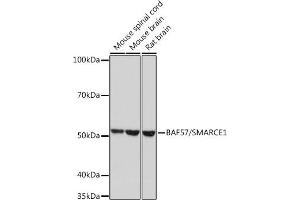 Western blot analysis of extracts of various cell lines, using B/SM Rabbit mAb (ABIN1679391, ABIN3018128, ABIN3018129 and ABIN7101578) at 1:1000 dilution.