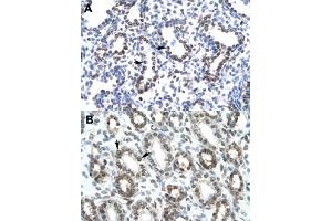 Immunohistochemical staining (Formalin-fixed paraffin-embedded sections) of human lung (A) and human kidney (B) with HEY1 polyclonal antibody  at 4-8 ug/mL working concentration. (HEY1 antibody  (C-Term))