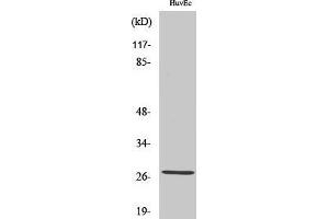 Western Blotting (WB) image for anti-Acidic (Leucine-Rich) Nuclear phosphoprotein 32 Family, Member C (ANP32C) (Internal Region) antibody (ABIN3186535) (ANP32C antibody  (Internal Region))