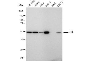 Western blotting analysis using ADK antibody (ABIN7797517).