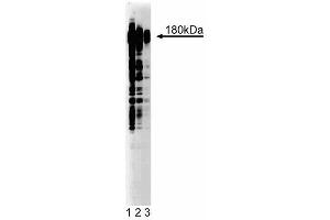Western blot analysis of Phosphotyrosine on A431 lysate. (Phosphotyrosine antibody)