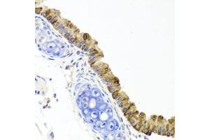 Immunohistochemistry of paraffin-embedded mouse lung using TOPBP1 antibody (ABIN6134114, ABIN6149397, ABIN6149400 and ABIN6216254) at dilution of 1:100 (40x lens). (TOPBP1 antibody  (AA 1-100))