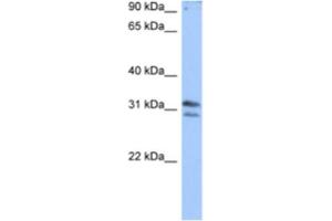 Western Blotting (WB) image for anti-RNA (Guanine-9-) Methyltransferase Domain Containing 3 (RG9MTD3) antibody (ABIN2462336) (RG9MTD3 antibody)