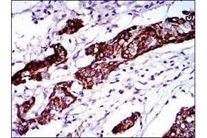 Immunohistochemistry (IHC) image for anti-Breast Cancer 1 (BRCA1) (AA 229-335) antibody (ABIN1846101)