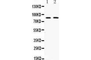 Western blot analysis of MUT expression in rat kidney extract ( Lane 1) and 22RV1 whole cell lysates ( Lane 2).