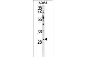 Western blot analysis of anti-WBP2 Antibody in A2058 cell line lysates (35ug/lane) (WBP2 antibody  (N-Term))