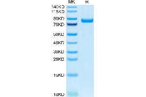 Human IL-5R alpha on Tris-Bis PAGE under reduced condition. (IL5RA Protein (AA 21-335) (Fc Tag))