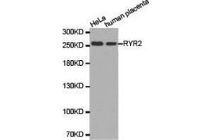 Western Blotting (WB) image for anti-Ryanodine Receptor 2 (Cardiac) (RYR2) antibody (ABIN1874679) (RYR2 antibody)