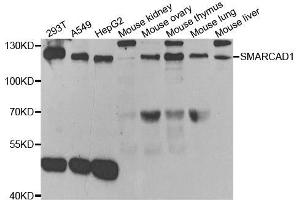 Western blot analysis of extracts of various cell lines, using SMARCAD1 antibody. (SMARCAD1 antibody)