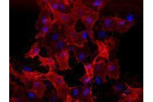 Immunofluorescence (IF) image for anti-VEGF Receptor 2 (VEGFR2) antibody (ABIN2664545) (VEGFR2/CD309 antibody)