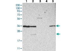 Western blot analysis of Lane 1: RT-4, Lane 2: U-251 MG, Lane 3: Human Plasma, Lane 4: Liver, Lane 5: Tonsil with OTUD6B polyclonal antibody  at 1:250-1:500 dilution. (OTUD6B antibody)