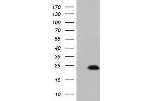 Western Blotting (WB) image for anti-MOB Kinase Activator 1B (MOB1B) antibody (ABIN1499533)