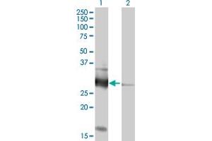 Western Blot analysis of VAPB expression in transfected 293T cell line by VAPB MaxPab polyclonal antibody. (VAPB antibody  (AA 1-243))