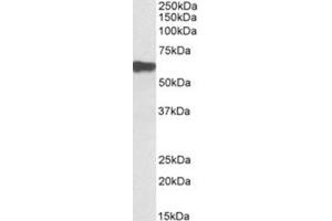 Western Blotting (WB) image for anti-Myotilin (MYOT) (AA 209-221), (Internal Region) antibody (ABIN1449481) (Myotilin antibody  (Internal Region))