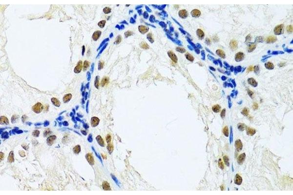 DDB1 antibody