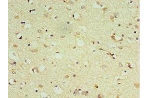 Immunohistochemistry of paraffin-embedded human brain tissue using ABIN7149474 at dilution of 1:100 (DRD3 antibody  (AA 213-329))