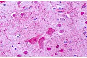 Anti-GPR137 antibody IHC staining of human brain, cortex, cerebellum. (GPR137 antibody  (Cytoplasmic Domain))