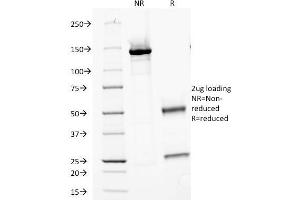 SDS-PAGE Analysis Purified PNA Mouse Monoclonal Antibody (PN-15). (CA9 antibody)
