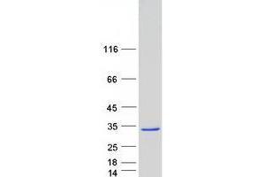 Western Blotting (WB) image for WDYHV Motif Containing 1 (WDYHV1) protein (Myc-DYKDDDDK Tag) (ABIN2735546)