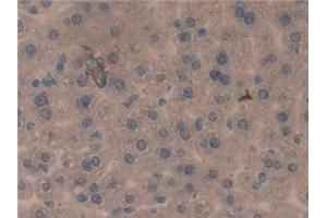 Detection of PDL1 in Mouse Liver Tissue using Polyclonal Antibody to Programmed Cell Death Protein 1 Ligand 1 (PDL1) (PD-L1 antibody  (AA 34-241))