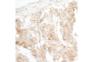 Immunohistochemistry (IHC) image for anti-rho/rac Guanine Nucleotide Exchange Factor (GEF) 2 (ARHGEF2) (AA 625-675) antibody (ABIN7454540)