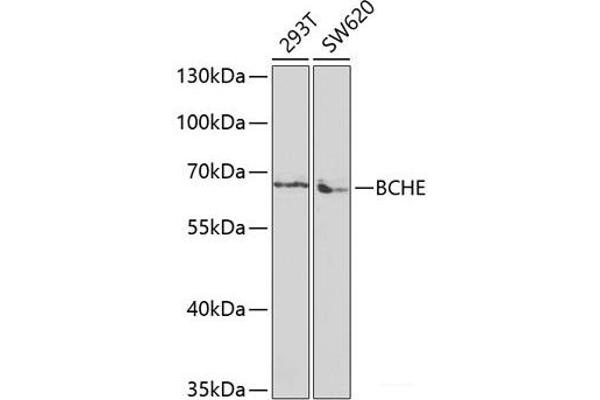 Butyrylcholinesterase antibody